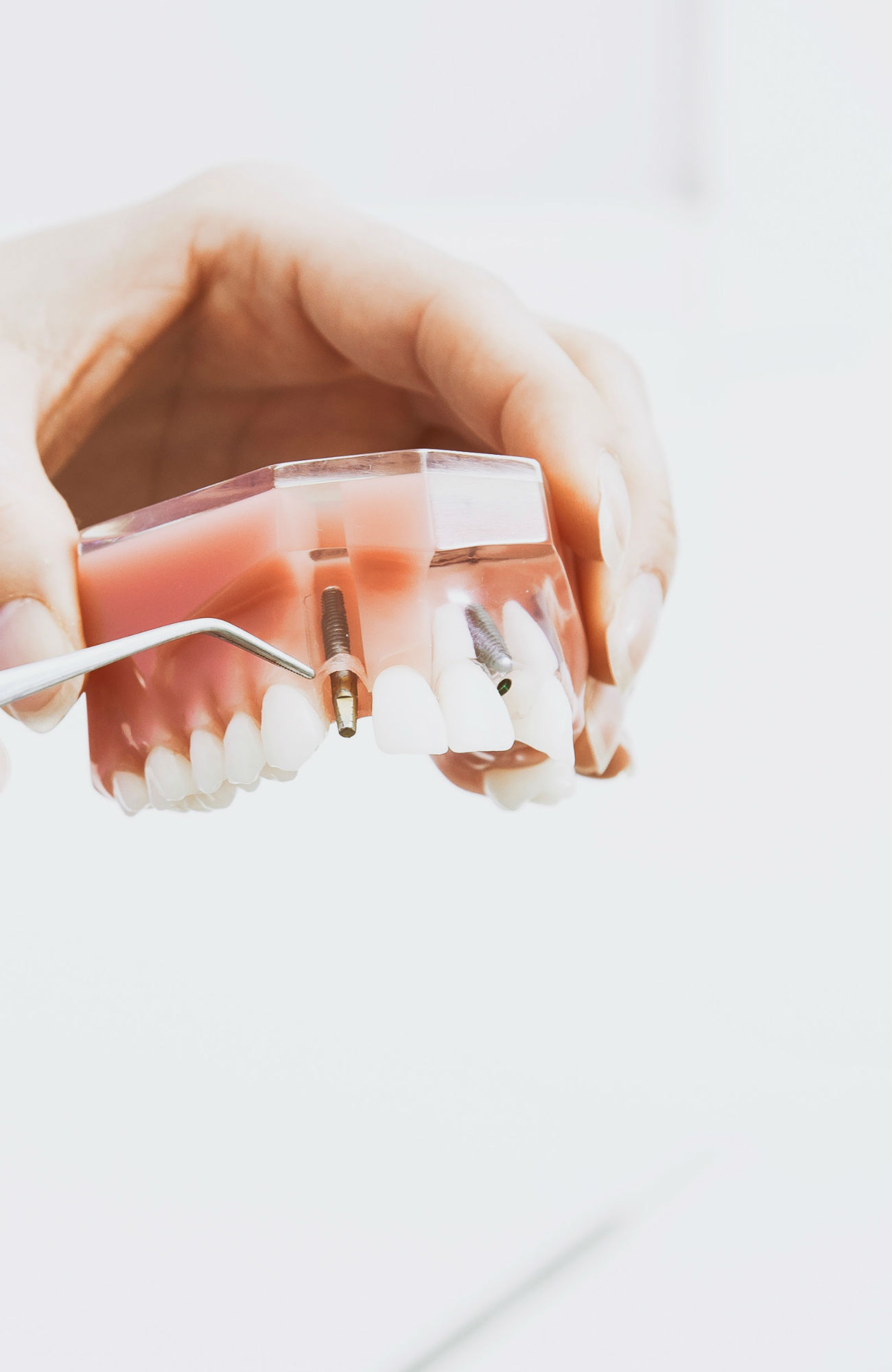 Studera tandvård utomlands