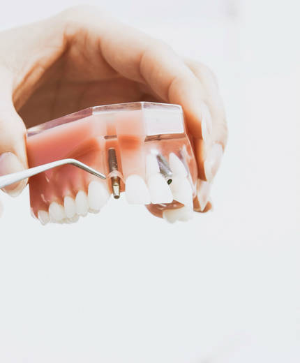 Studera tandvård utomlands